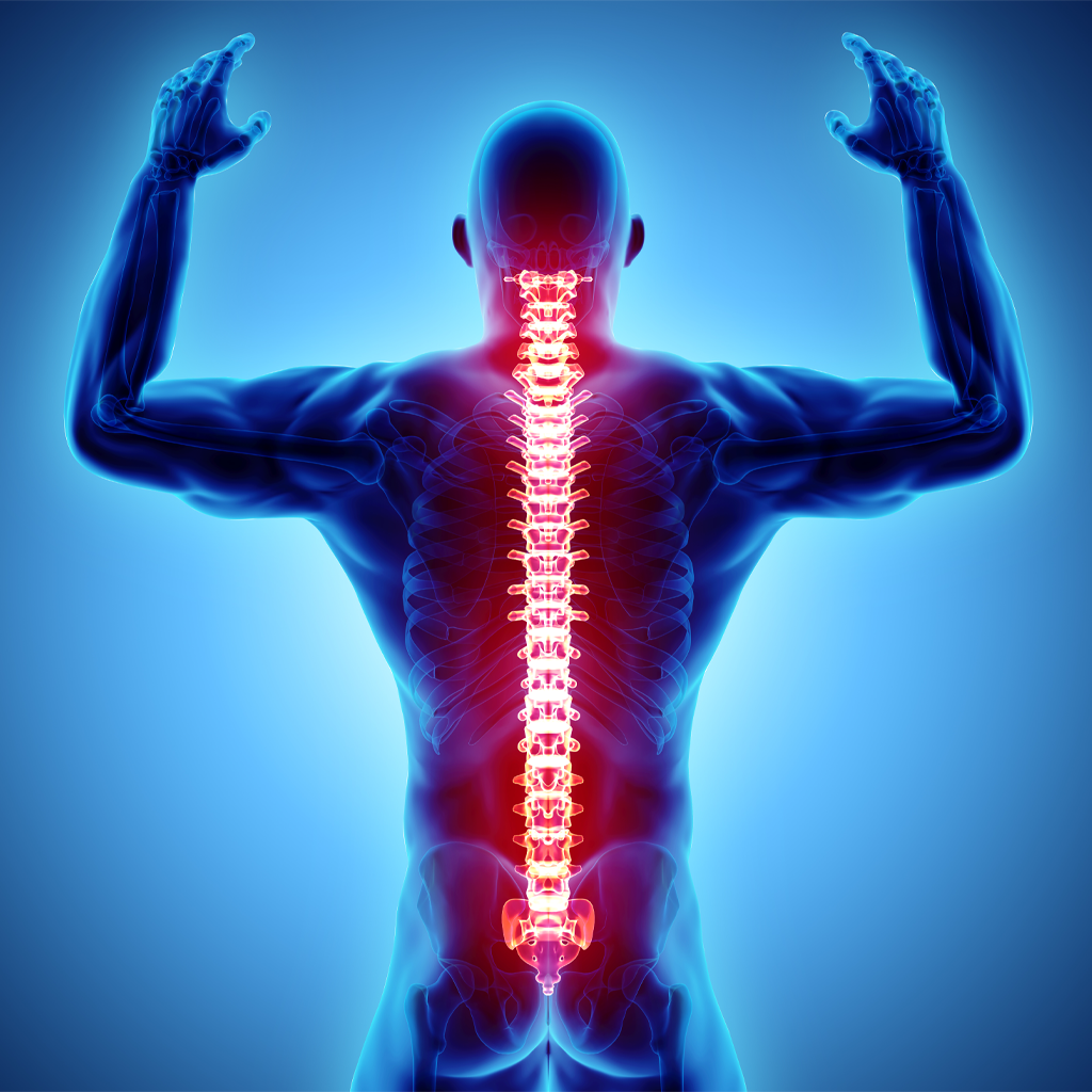 spine fractures and treatments - Minnesota