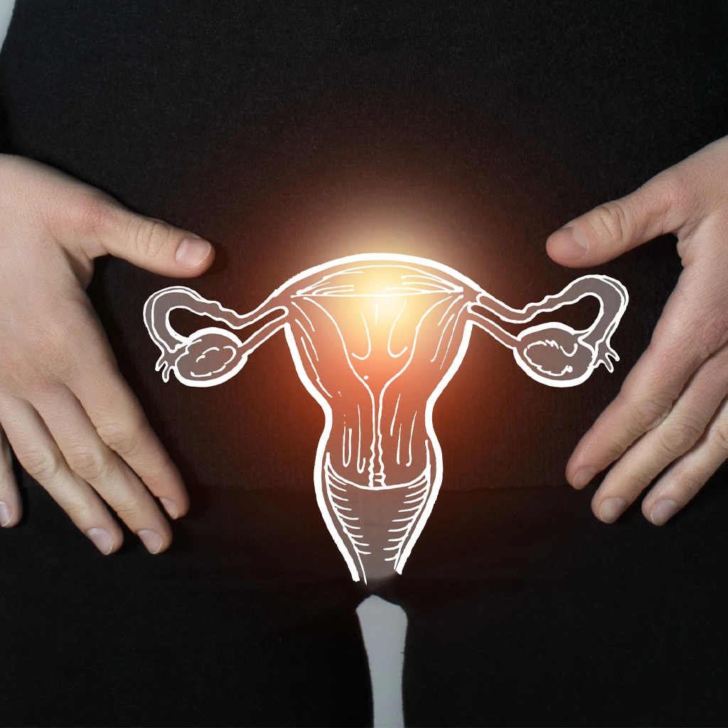 What are uterine fibroids? North Star Vascular adn Interventional