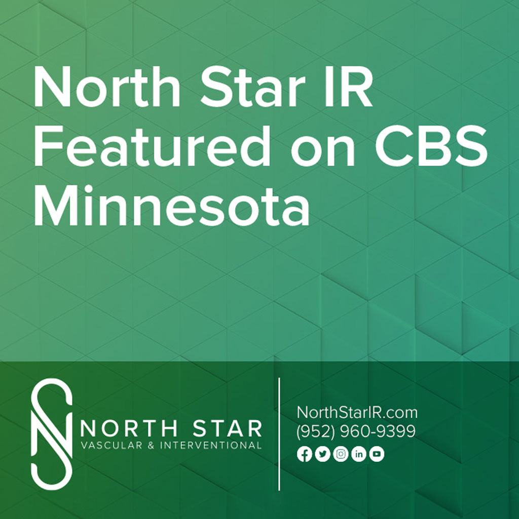 North Star on CBS Cover