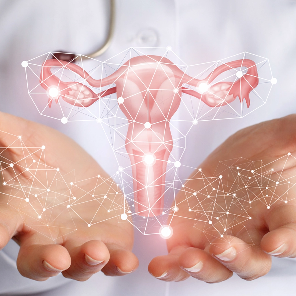 ovarian vein embolization (OVE) in MN for pelvic congestion syndrome