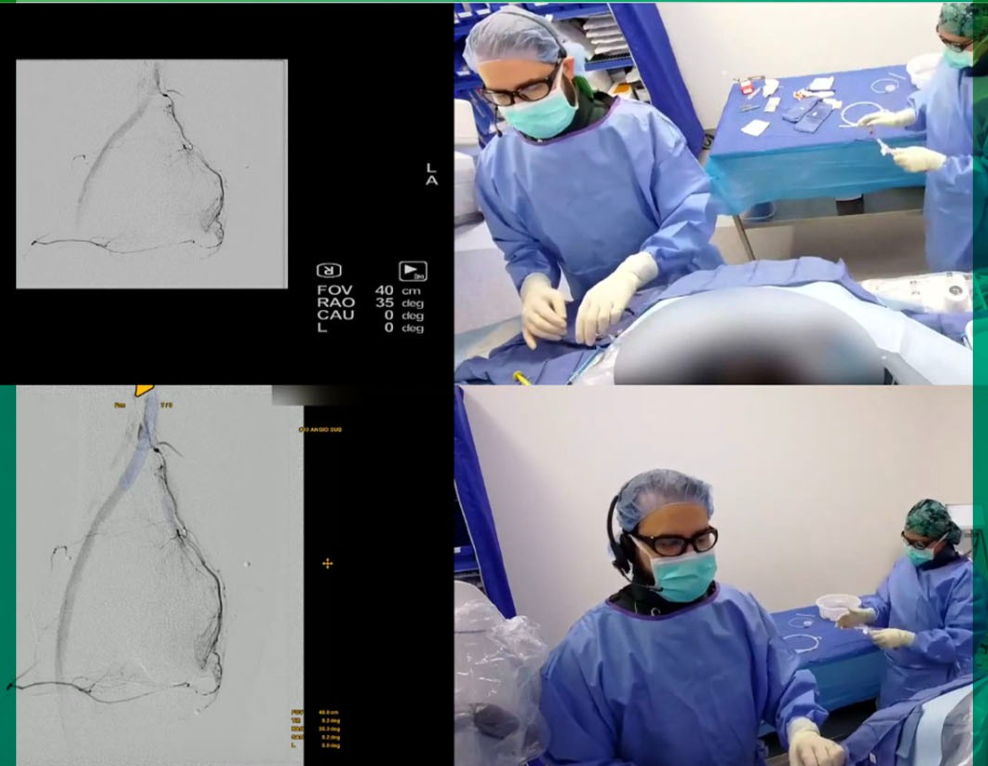 Live-streaming GAE Procedure