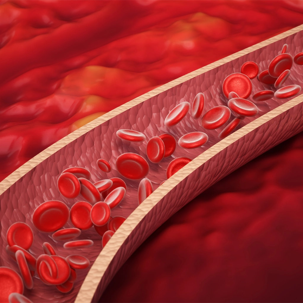 Fibromuscular dysplasia treatment