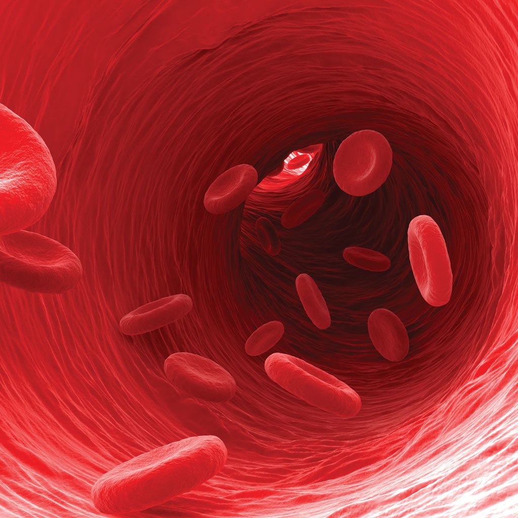 Blood Flow Signs of Poor Circulation